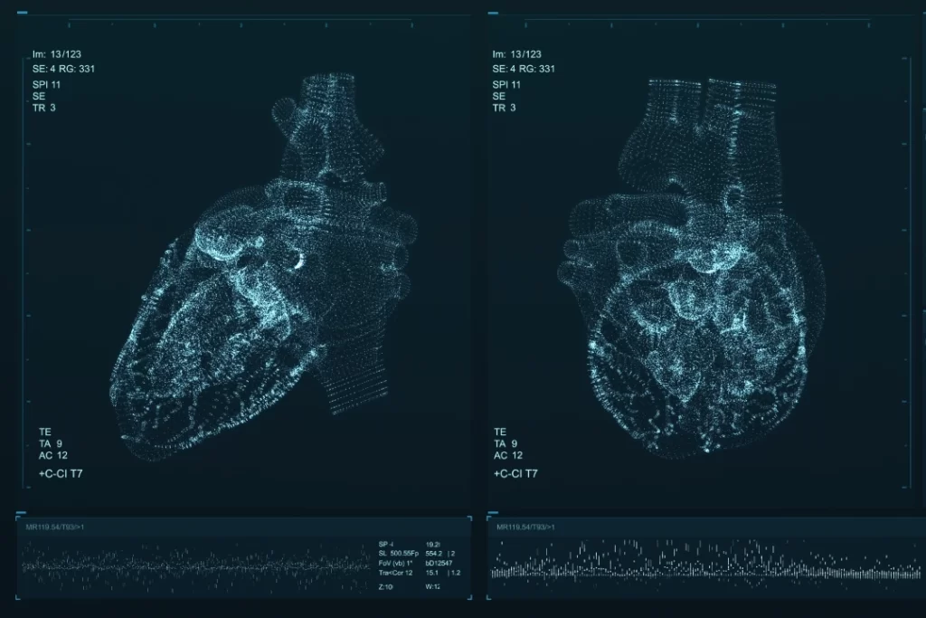 cardiac screening Singapore.