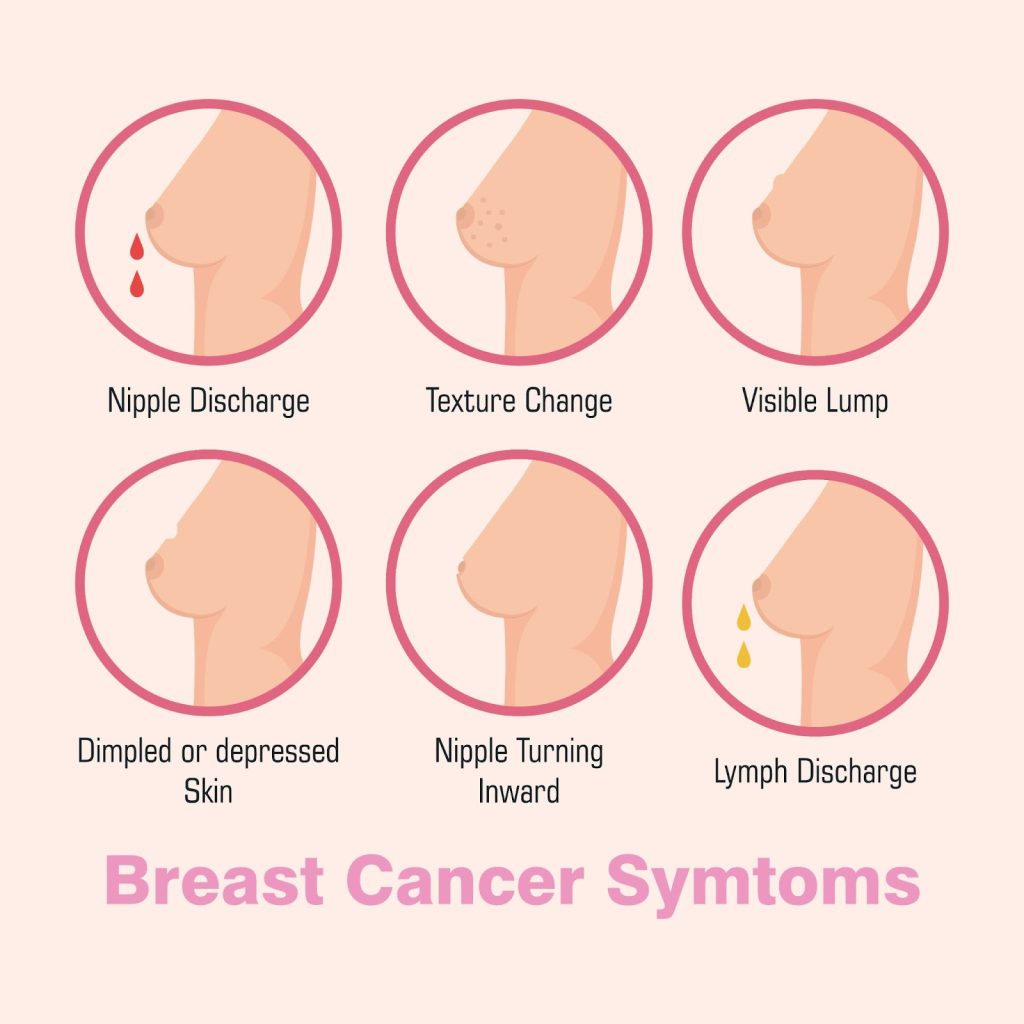 mammogram procedure singapore