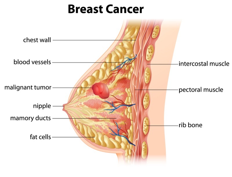 early breast cancer screening singapore